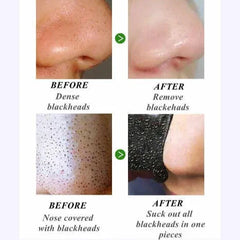 Dear She Charcoal Nose Pore Cleansing 10 Strips Dear she