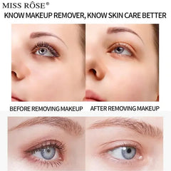 Miss Rose Thermal Micellar Water - 180ml Miss Rose