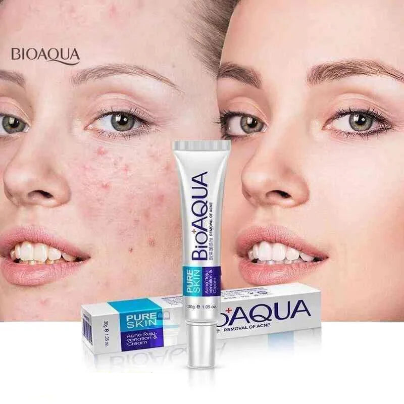 Bioaqua Acne Removal Cream Spot-Free Skin - 30g Bioaqua