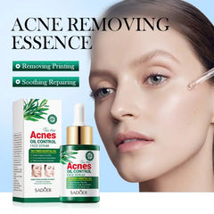 Sadoer Tea Tree Oil Control Anti-Acne Serum Essence 30ml Sadoer