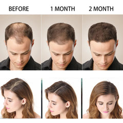Disaar Hair Shampoo Anti-Hair Loss - 200ml Disaar