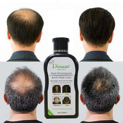 Disaar Hair Shampoo Anti-Hair Loss - 200ml Disaar