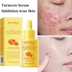 BIOAQUA Anti-Oxidation Acne Removal Turmeric Face Serum- 30ml Bioaqua