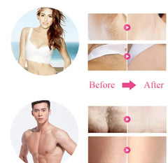Babyverse IPL Laser Epilator Women Laser Hair Removal Babyverse