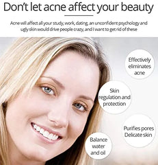 Aichun beauty Anti Acne Whitening Facial Serum - 30ml Aichun Beauty