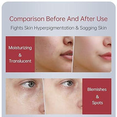 Zooson Freckle Cream Tube Zooson