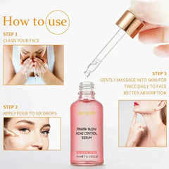 Muicin V9 Pinkish Glow Anti Acne Face Serum – 15ml Muicin