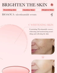 BIOAQUA Dispel Frekle Stable Soothing Nicotinamide Serum- 30ml Bioaqua