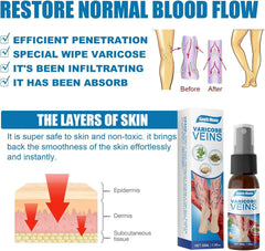 South Moon Vein Healing Varicose Veins Treatment Spray - 30ml South Moon