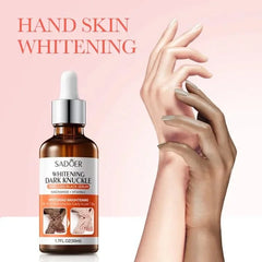 Sadoer Dark Knuckle Whitening Niacinamide Vitamin C Body Serum - 50ml Sadoer