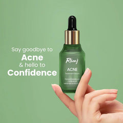 Rivaj Acne Treatment Serum - 30ml Rivaj