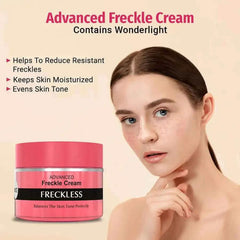 Vince Advanced Freckle Cream Vince