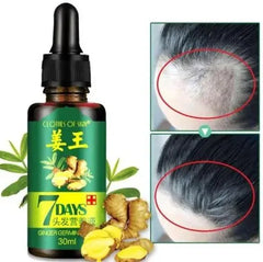 Aichun Beauty 7 Days Ginger Hair Growth Oil Serum For Damaged Hair Aichun Beauty