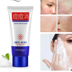 Bioaqua Anti‑Acne Pox Repair Pore Oil Control Anti‑Dirt Bubble Foam Face Wash Cleanser - 100g Bioaqua