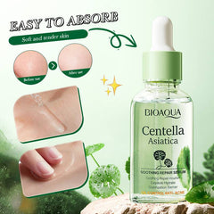 Bioaqua Centella Asiatica Soothing Repair Anti Acne Face Serum Essence - 30ml Bioaqua