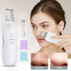 Face Scrubber Machine For Blackhead Cosmia.pk