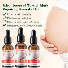 KORMESIC Skincare for Natural Belly Care Remover Stretch Mark Oil - 100ml KORMESIC