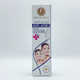 Heaven Dove Anti Acne Cream – 50g Heaven Dove