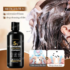 KORMESIC Minoxidil with Biotin Hair Grower Shampoo - 300ml KORMESIC