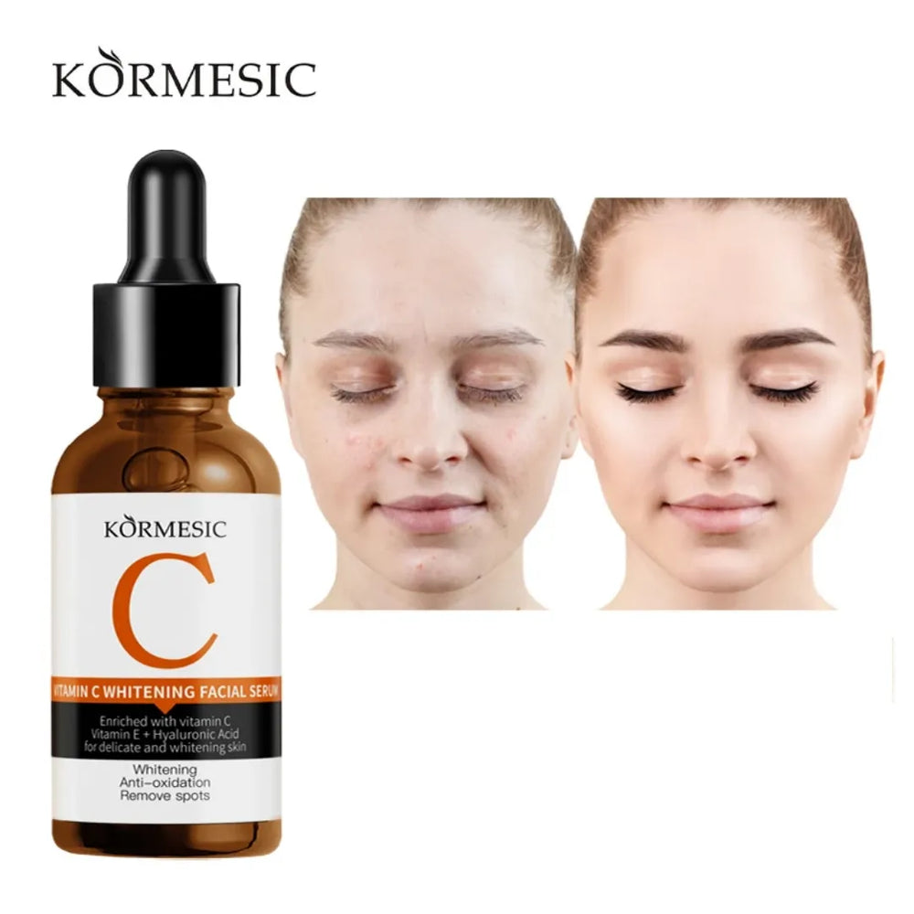 KORMESIC Vitamin C Whitening Facial Serum - 30ml KORMESIC