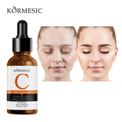 KORMESIC Vitamin C Whitening Facial Serum - 30ml KORMESIC