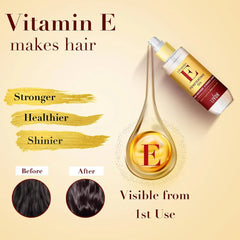 Livon Vitamin E Penetrating Serum Oil For Stronger & Thicker Hair - 100ml Livon