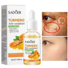 Sadoer Turmeric Anti Oxidation Face Serum - 30ml Sadoer