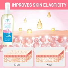 Aichun Beauty Anti Stretch Mark Body Oil - 120ml Aichun Beauty