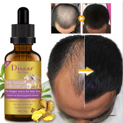 Disaar Anti-Hair Loss Ginger Oil – 30g Disaar
