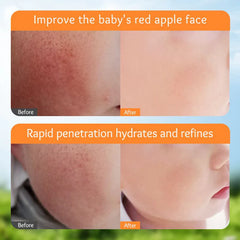 Sadoer Calendula Amino Acid Formula Baby Moist Cream – 50 g Sadoer