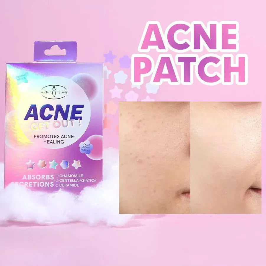 Aichun Beauty Acne Get Out! Patches - Each Aichun Beauty