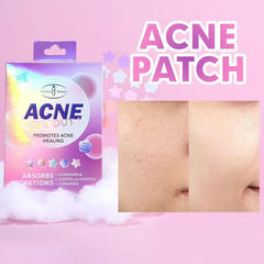 Aichun Beauty Acne Get Out! Patches - Each Aichun Beauty