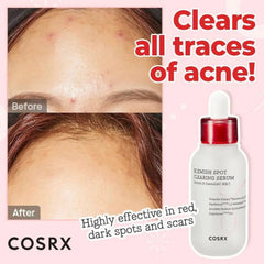 Cosrx Blemish Spot Clearing Serum - 40ml Cosrx
