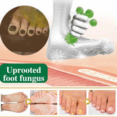 Athlete's Foot Herbal Antibacterial Spray Athlete's