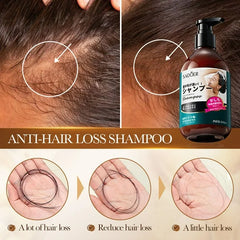 SADOER Anti Hair Loss Shampoo Anti-dandruff Hair Growth Shampoo - 300ml Sadoer