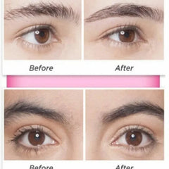 Flawless Hair Remover – Instant & Painless Facial Hair Removal Flawless
