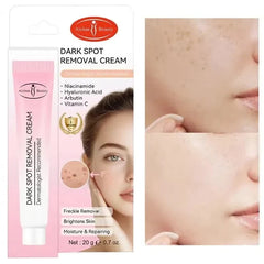 Aichun Beauty Dark Spot Removal Cream - Each Aichun Beauty