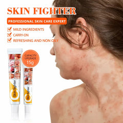 Skin Fighter Herbal Repair Ointment - Each Skin Fighter