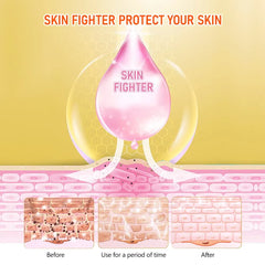 Skin Fighter Herbal Repair Ointment - Each Skin Fighter