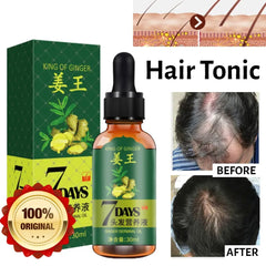 Aichun Beauty 7 Days Ginger Hair Growth Oil Serum For Damaged Hair Aichun Beauty