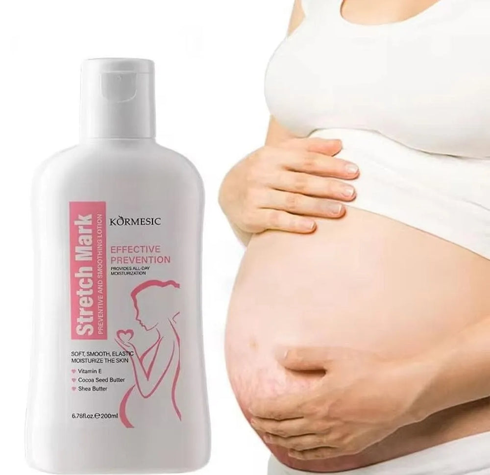 KORMESIC Stretch Mark Care Lotion – 200ml KORMESIC
