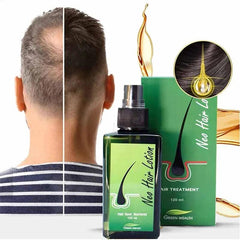 New Hair Lotion Hair Growth (Made in P.R.C) Cosmia.pk
