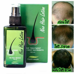 New Hair Lotion Hair Growth (Made in P.R.C) Cosmia.pk