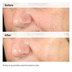 The Ordinary Alpha Arbutin 2% + HA Serum - 30ml The Ordinary