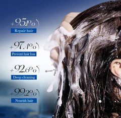 SADOER 5% Minoxidil Biotin Hair Growth Shampoo 300ml SADOER