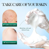 Sadoer Mousse Facial Cleanser Tea Tree 150g