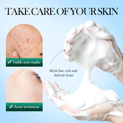 Sadoer Mousse Facial Cleanser Tea Tree 150g Sadoer