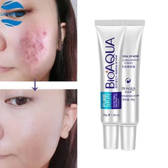 BIOAQUA- Acne Removal Pure Skin Cream - 30g Bioaqua