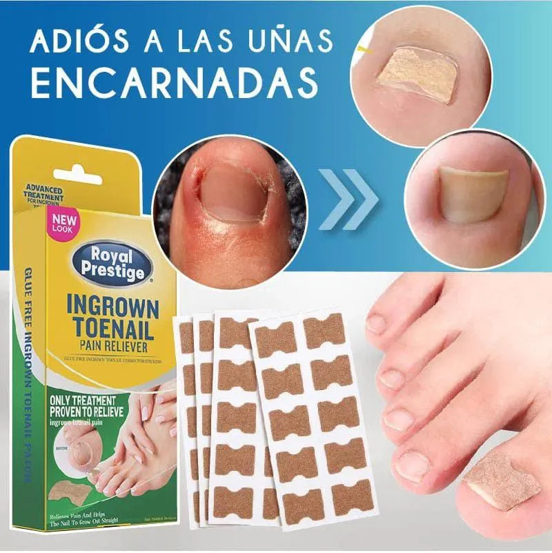 Royal Prestige Ingrown Toenail Pain Reliever 30 Patches Royal Prestige