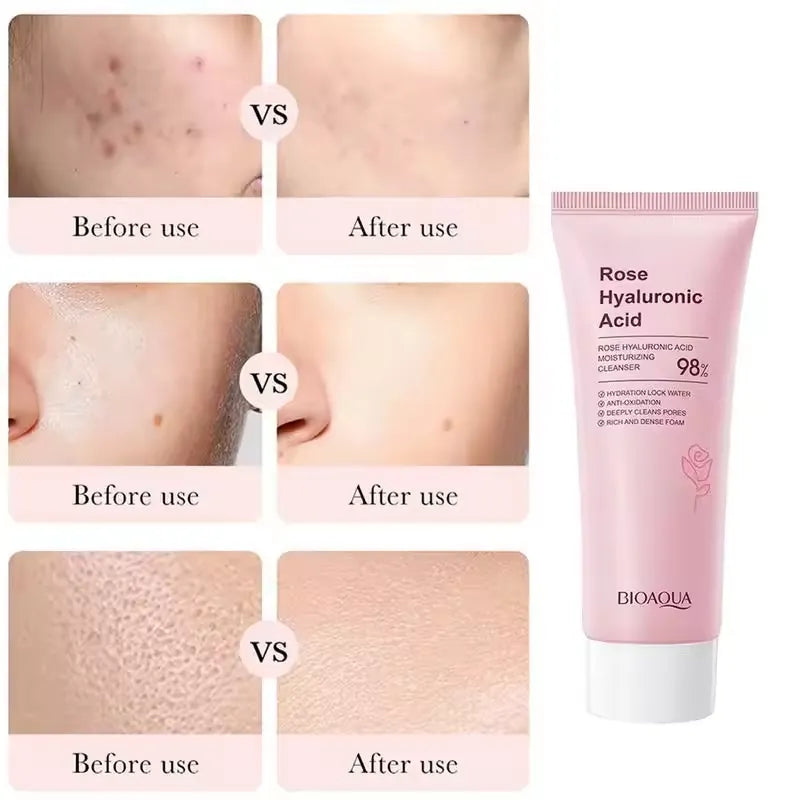 BIOAQUA Rose Hyaluronic Acid Moisturizing Cleanser – 100g Bioaqua